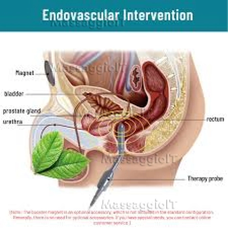 Massaggiatrice Torino Massaggiatrice esperta in relax e stimolazione prolungata della ghiandola prostatica