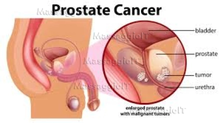 Massaggiatrice Torino Massaggiatrice esperta in relax e stimolazione prolungata della ghiandola prostatica