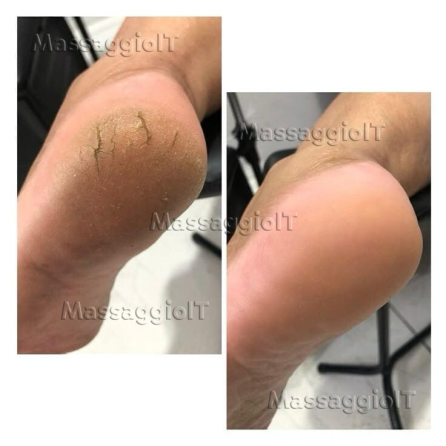 Centro massaggi Catania ✨🌿SONO ARRIVATE NUOVE MANI – BENESSERE TOTALE 🌿✨
