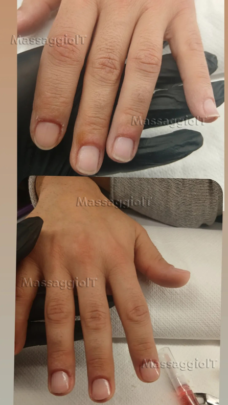 Centro massaggi Catania Estate = gambe fuori, pancia scoperta, costumi. È il momento in cui tutte vogliono sentirsi al top. Ecco come “prepariamo l’estate” in Kathestetica 👇